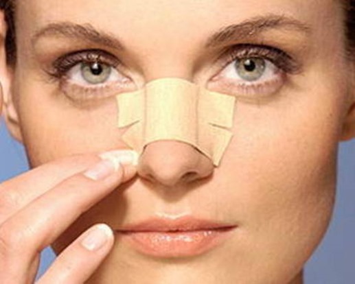 Nâng mũi cần đảm bảo chế độ chăm sóc sau phẫu thuật
